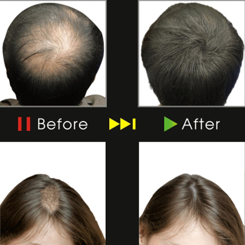 HairMix Hair Building Fiber with Hair Locking Spray - Image 3